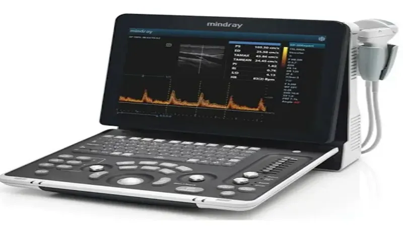 ecógrafo ultrasonido imagenes en tiempo real